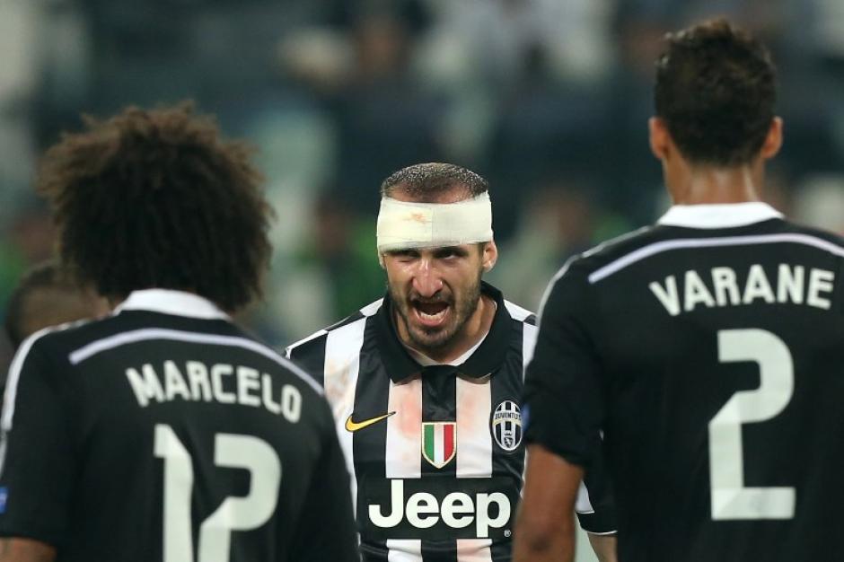 Chiellini, importante en el triunfo durante la serie ante el Real Madrid, podr&iacute;a perderse la final ante el Barcelona. (Foto: AFP)