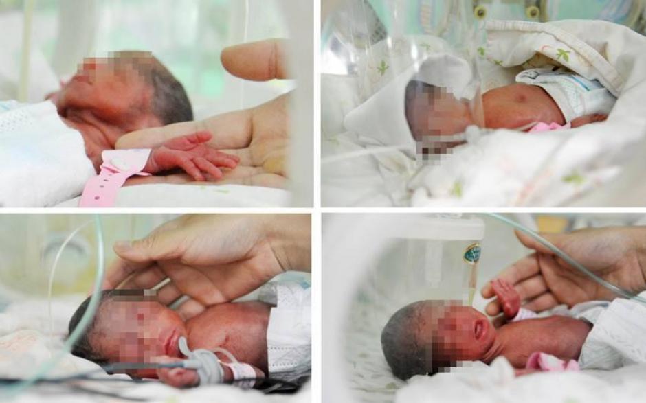 Una abuela de 65 a&ntilde;os dio a luz a cuatrillizos en Alemania.