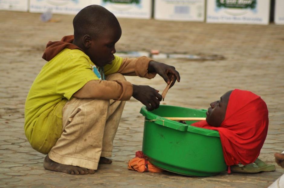 Rahama Hurana es un joven de 19 a&ntilde;os que sufre de una rara discapacidad que le impidi&oacute; desarrollar su cuerpo. (Foto: El Mundo)