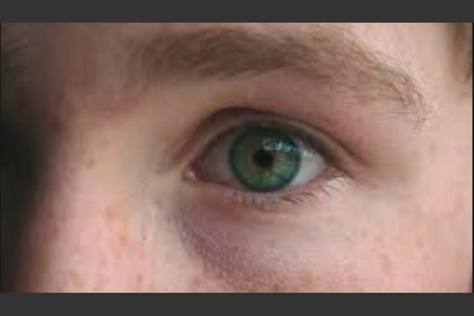 Cada enfermedad presenta una se&ntilde;al espec&iacute;fica en tu mirada. (Foto:&nbsp;pixfeeds)