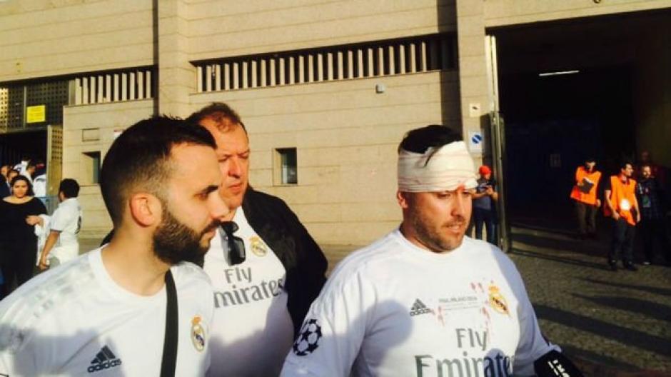 Un seguidor del Real Madrid result&oacute; con una herida en la cabeza tras los disturbios provocados por radicales del Atl&eacute;tico de Madrid. (Foto: Twitter)