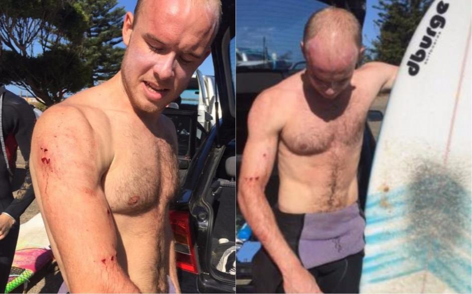 El surfista fue atacado en las costas australianas. (Foto: The Sun)