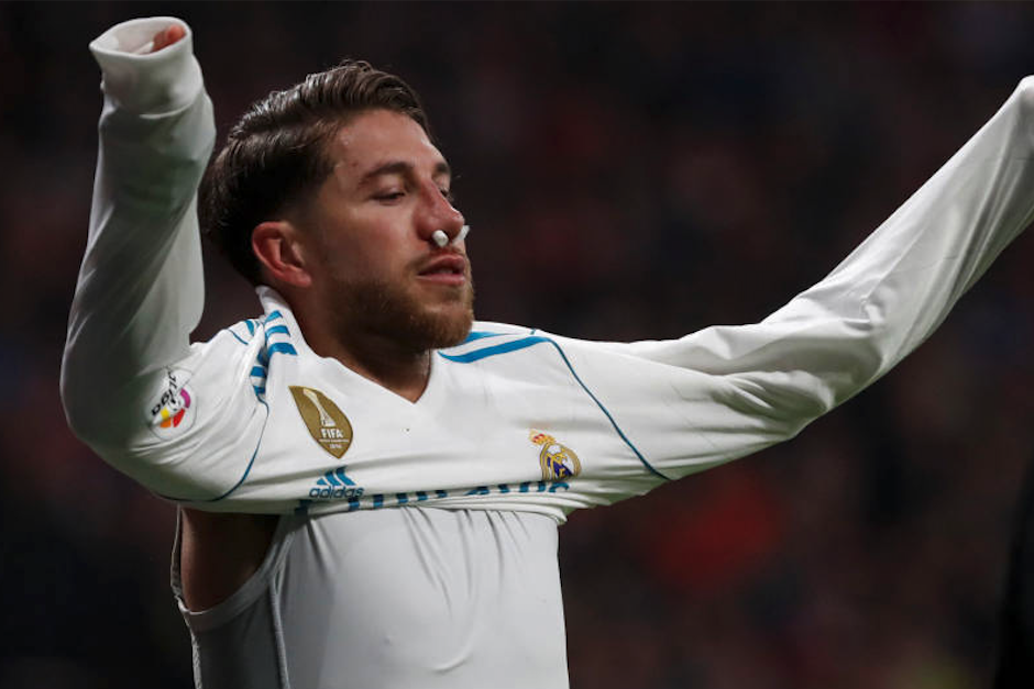 Hace 10 a&ntilde;os, el defensa tambi&eacute;n sufri&oacute; una lesi&oacute;n en la nariz y jug&oacute; con una m&aacute;scara similar. (Foto: El Confidencial)