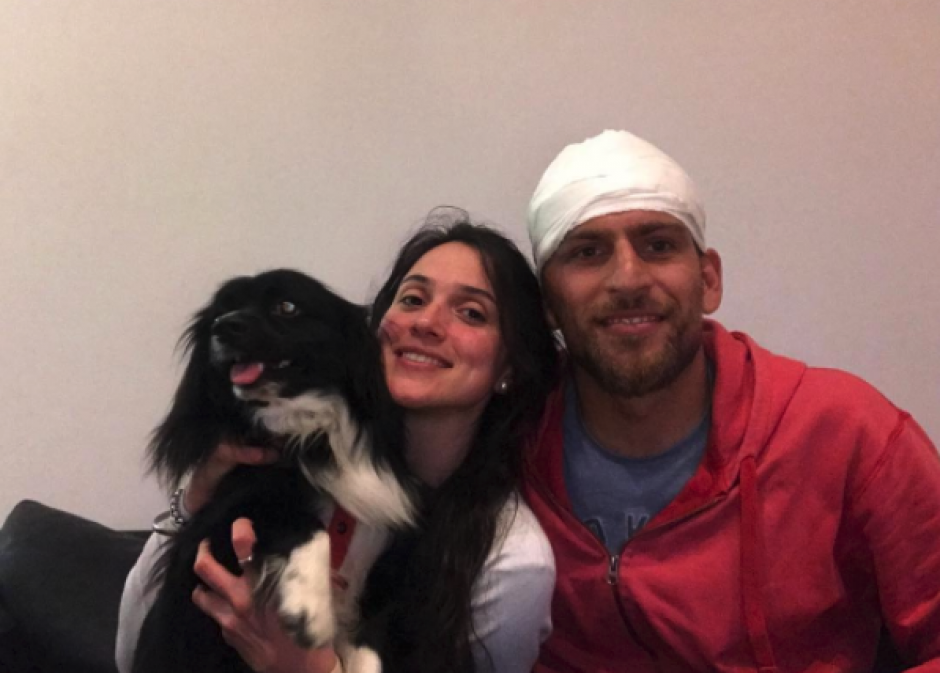 Francisco Vazzoler sufrió una escalofriante herida en la cabeza en un partido en Argentina. (Foto: Instagram)