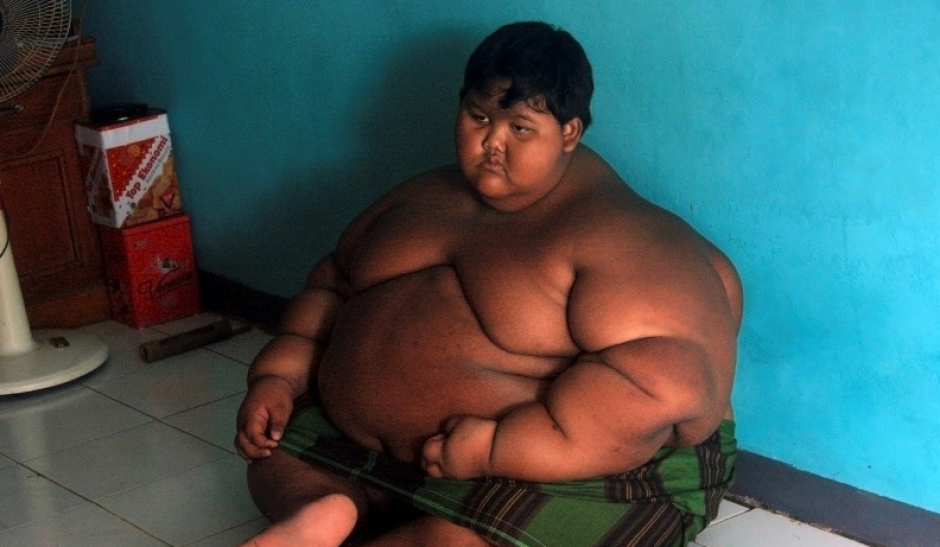 En el 2016, Arya Permana pesaba unos 200 kilogramos. (Foto: Cater News)