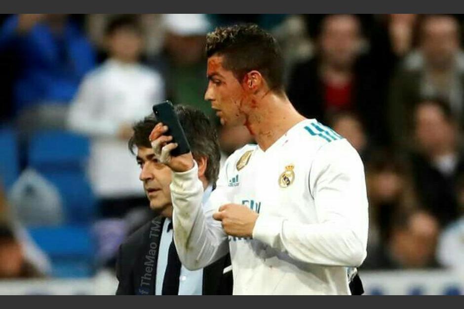 Cristiano Ronaldo pidió un celular al cuerpo médico para ver la gravedad de su herida. (Foto: AFP)