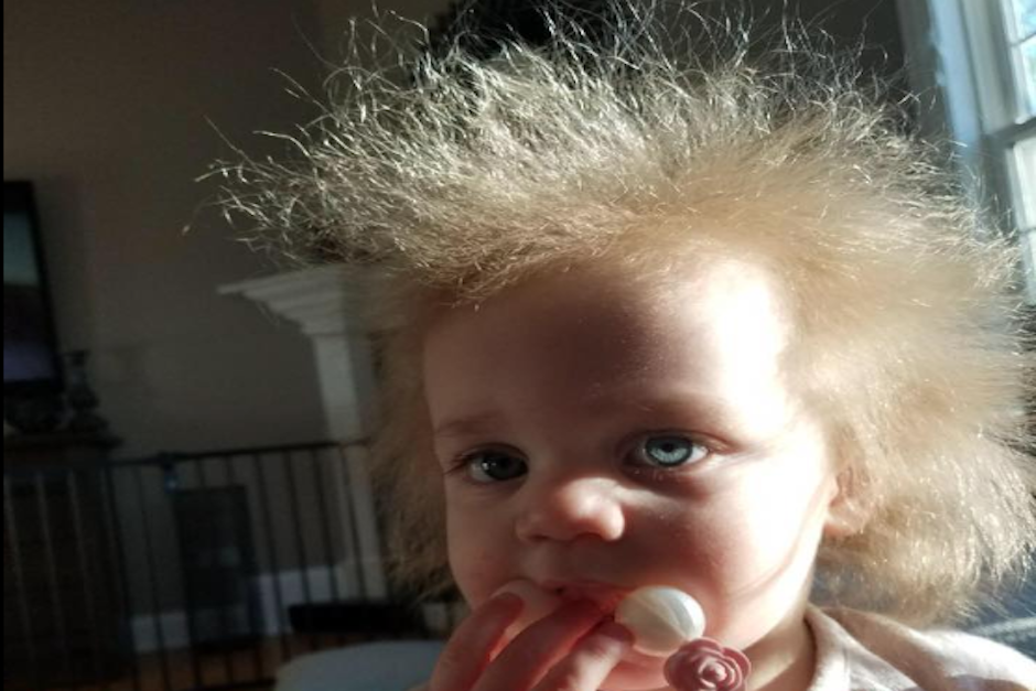 A la peque&ntilde;a le fue detectado el s&iacute;ndrome de cabello impeinable cuando ten&iacute;a 4 meses. (Foto: Facebook/Baby Einstein)