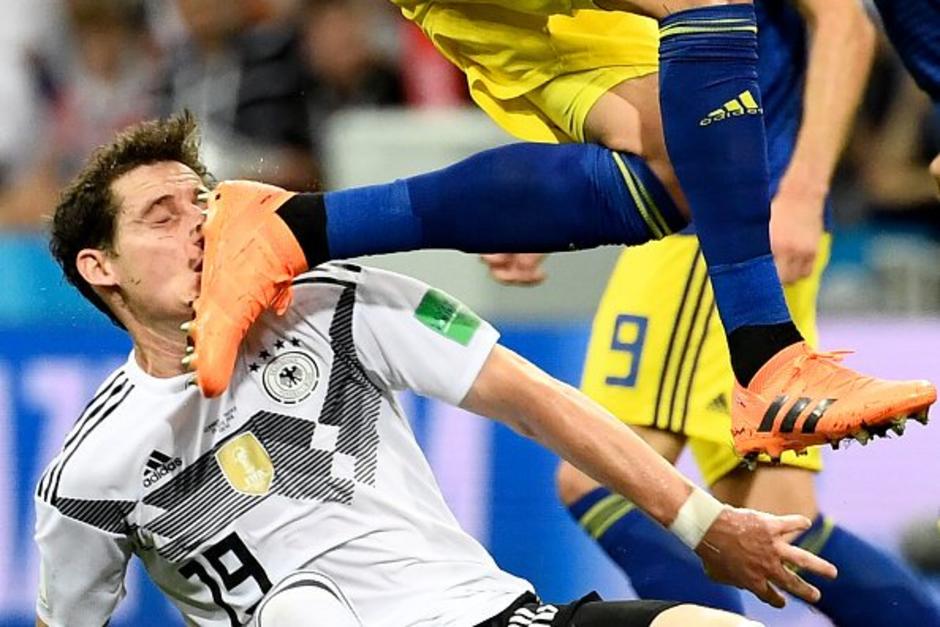 Sebastian Rudy recibió una patada sin mala intensión y la hemorragia lo deja fuera del partido. (Foto: AFP)