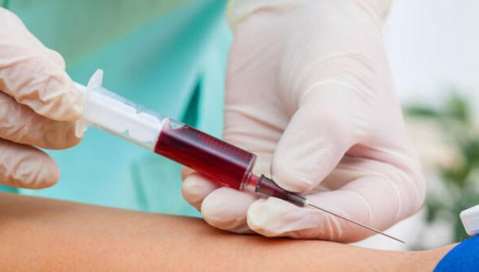 Un An lisis De Sangre Podr a Determinar Cu nto Tiempo Vivir s