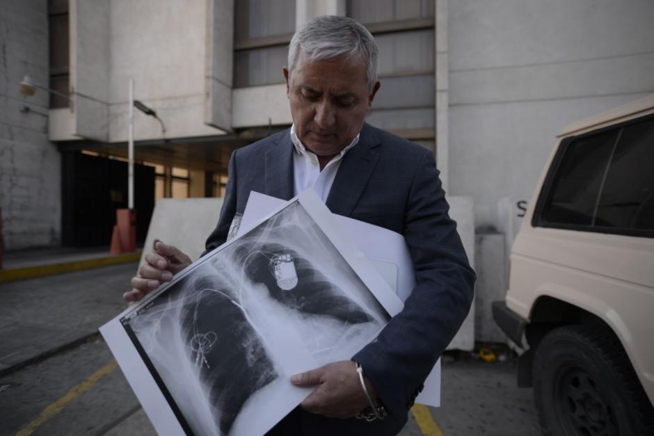 Otto P&eacute;rez Molina habl&oacute; sobre la enfermedad que supuestamente padece. (Foto: Wilder L&oacute;pez/Soy502)&nbsp;