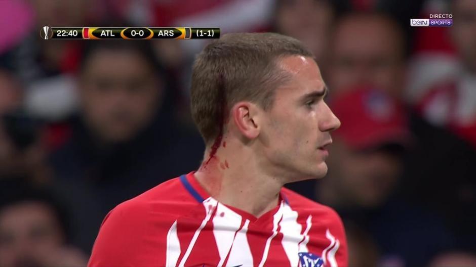Antoine Griezmann sufri&oacute; un golpe en la cabeza que le ocasion&oacute; una hemorragia. (Foto: Captura de video)