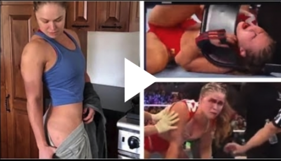 Ronda Rousey muestra sus heridas de guerra tras la paliza sufrida ante Charlotte. (Foto: Instagram)