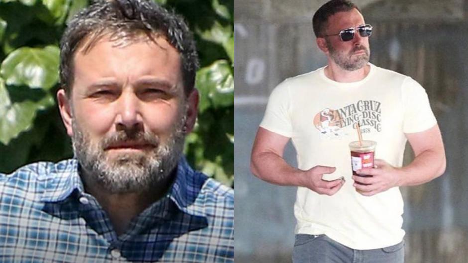 Es la tercera vez que Ben es ingresado a Rehabilitaci&oacute;n. (Foto: Archivo)