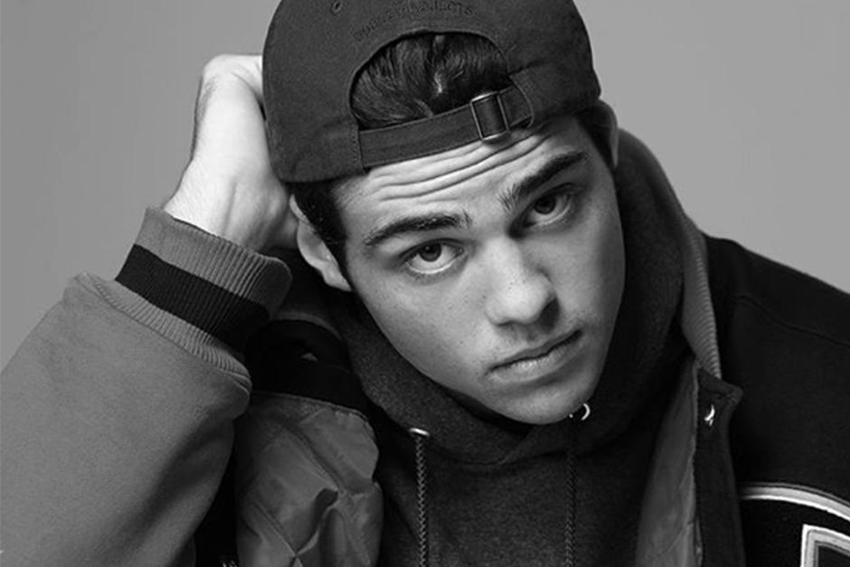 El actor revel&oacute; el motivo de su cicatriz. (Foto: Instagram)