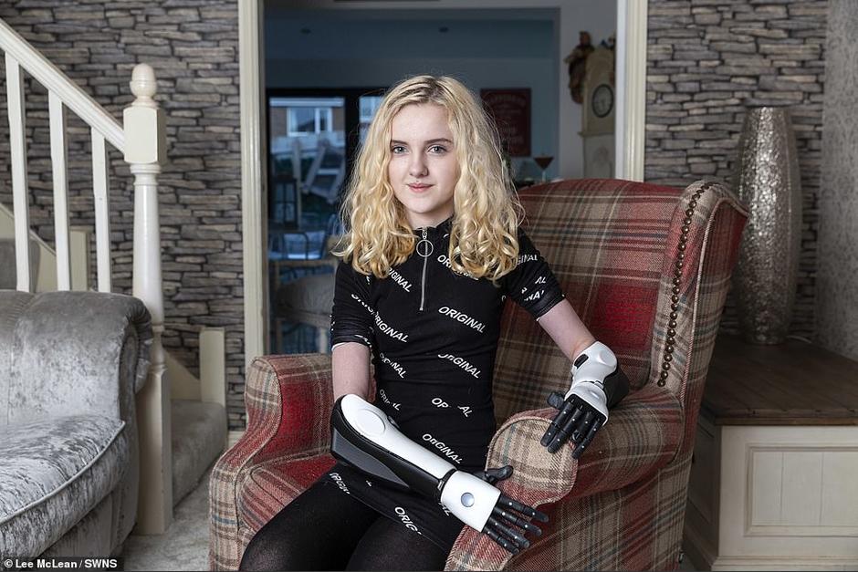 Tilly, una chica sorprendente, con una historia incre&iacute;ble. (Foto:Dily Mail)