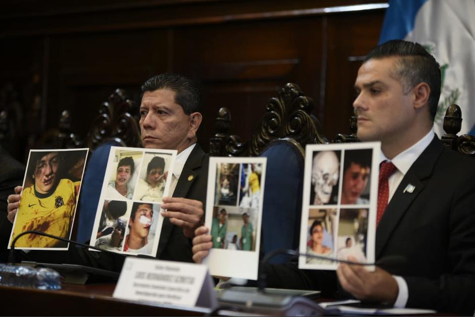 El equipo de Zimeri acusa a un adolescente de 16 años de cometer la nueva agresión. (Foto: Archivo/Soy502)