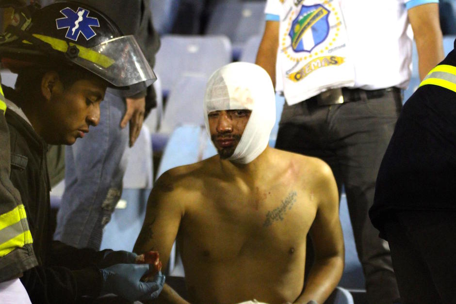 Una persona result&oacute; herida en la general sur y debi&oacute; de ser trasladado al hospital San Juan de Dios durante el cl&aacute;sico 309. (Foto: Luis Barrios/Soy502)