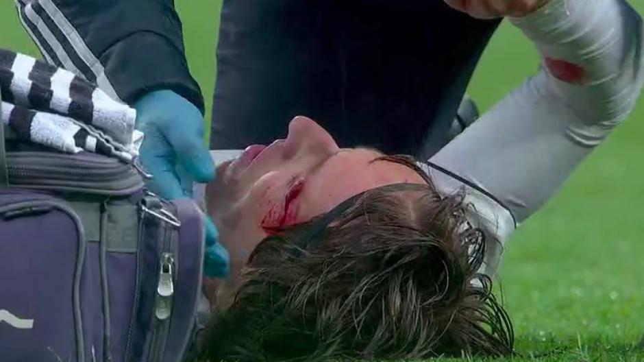 El golpe provocó una hemorragia al mediocampista que no le impidió marcar un gol. (Foto: captura pantalla)&nbsp;