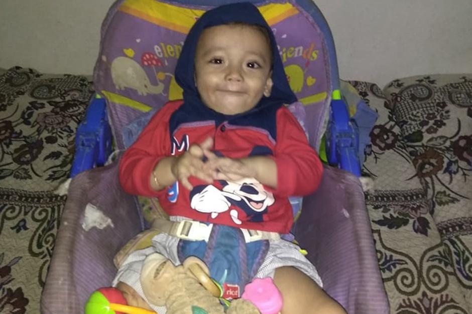 Walter Estuardo ingresó al Hospital de Zacapa por fiebre alta y salió sin su piernita derecha. (Foto: Cortesía de la familia)