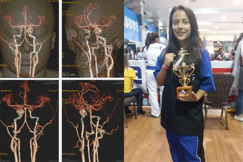 Conoce a esta joven promesa del karate que lucha contra un aneurisma. (Fotos: cortes&iacute;a familia)