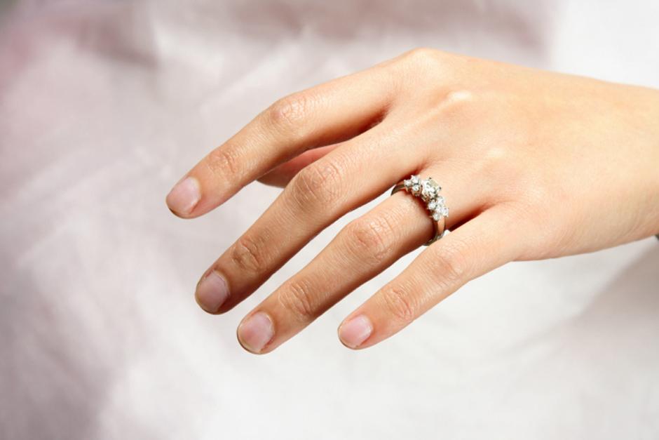 Una mujer no pod&iacute;a sacar el anillo de su dedo y ten&iacute;a pocas opciones. (Foto: Agencias)&nbsp;