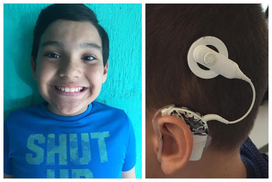 Ay&uacute;dale a o&iacute;r por primera vez. (Foto:Cortes&iacute;a familia)