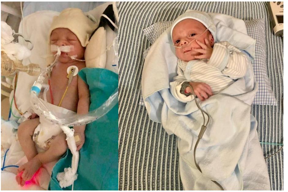 El antes y despu&eacute;s de este peque&ntilde;o guerrero. (Foto: Cortes&iacute;a familia)