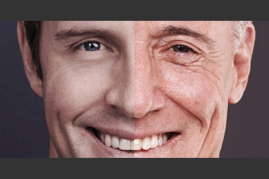 La secreci&oacute;n seb&aacute;cea causa que hayan m&aacute;s &ldquo;imperfecciones&rdquo; y brillo en la piel. (Foto: Cutique).