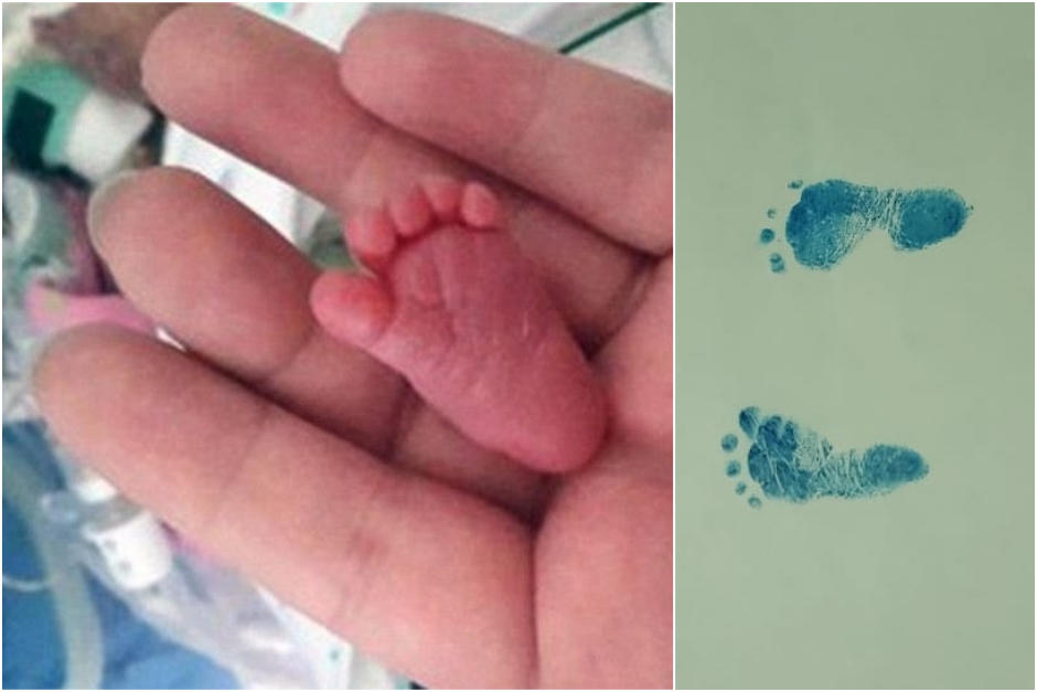 Tu puedes ayudar a este peque&ntilde;o guerrero. (Fotomontaje Erivan Campos)