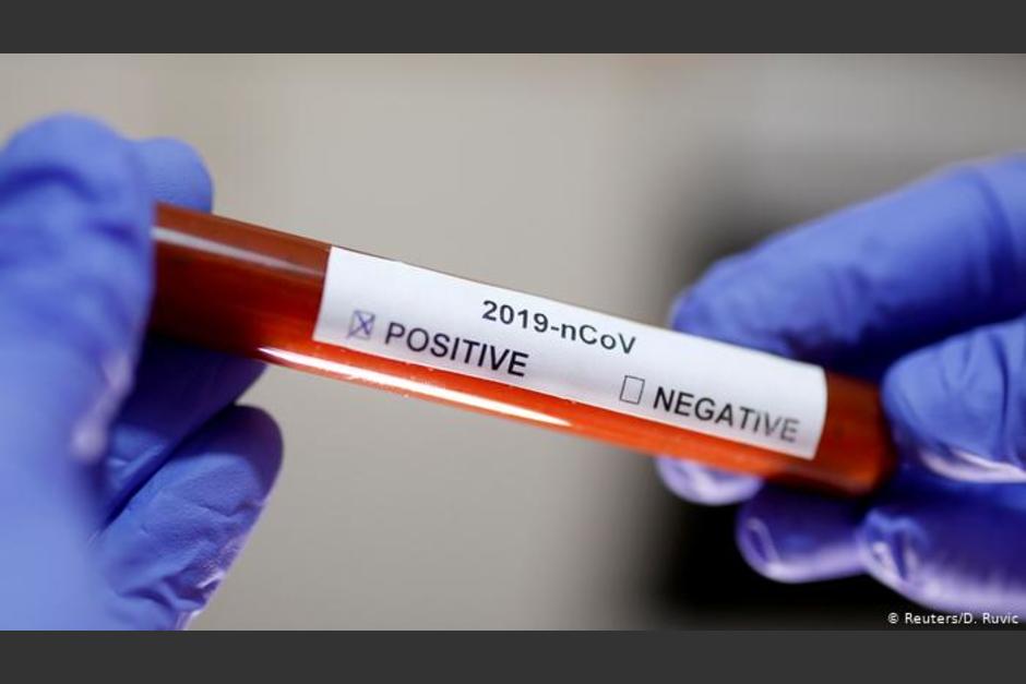 Fundesa compró más de 6 mil pruebas de Covid-19 que usará el Gobierno. (Foto: DW)