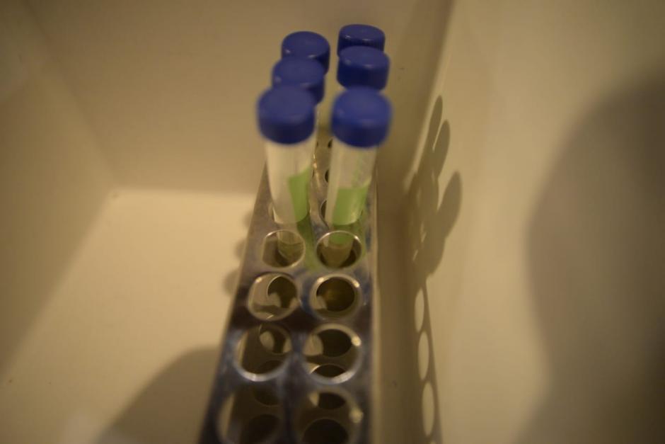 El Ministerio de Salud ten&iacute;a una proyecci&oacute;n m&aacute;s dr&aacute;stica para esta semana. (Foto: AFP)