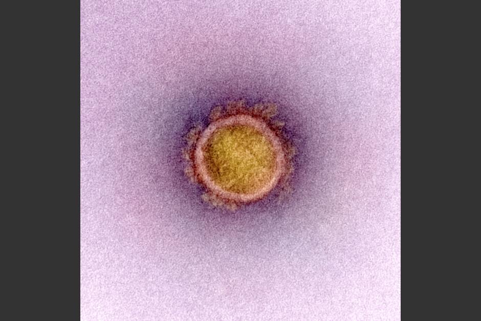 Es una "micrografía coloreada". Se observan sus protuberancias que sobresalen y forman una corona.