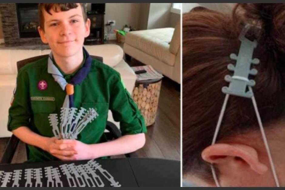 Callander ha hecho que el dise&ntilde;o de la correa est&eacute; disponible para que otros lo descarguen: c&oacute;digo abierto Thingiverse. (Foto Play)