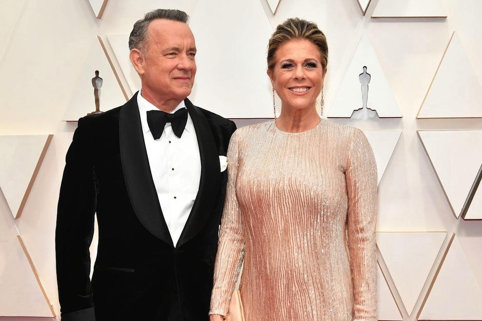 La cantante Rita Wilson contó acerca de los efectos secundarios de coronavirus. (Foto: AFP)&nbsp;