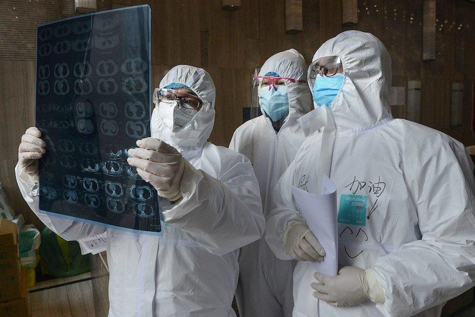 Los impactos neurol&oacute;gicos ser&iacute;an el resultado de una respuesta inmunol&oacute;gica hiperactiva (Foto: NYT)