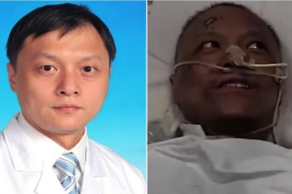 La piel del doctor Yi Fan, contagiado por coronavirus, cambió drásticamente de color. (Foto Infobae)