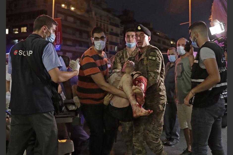 En videos compartidos en redes sociales se observan las fuertes explosiones. (Foto: AFP)&nbsp;
