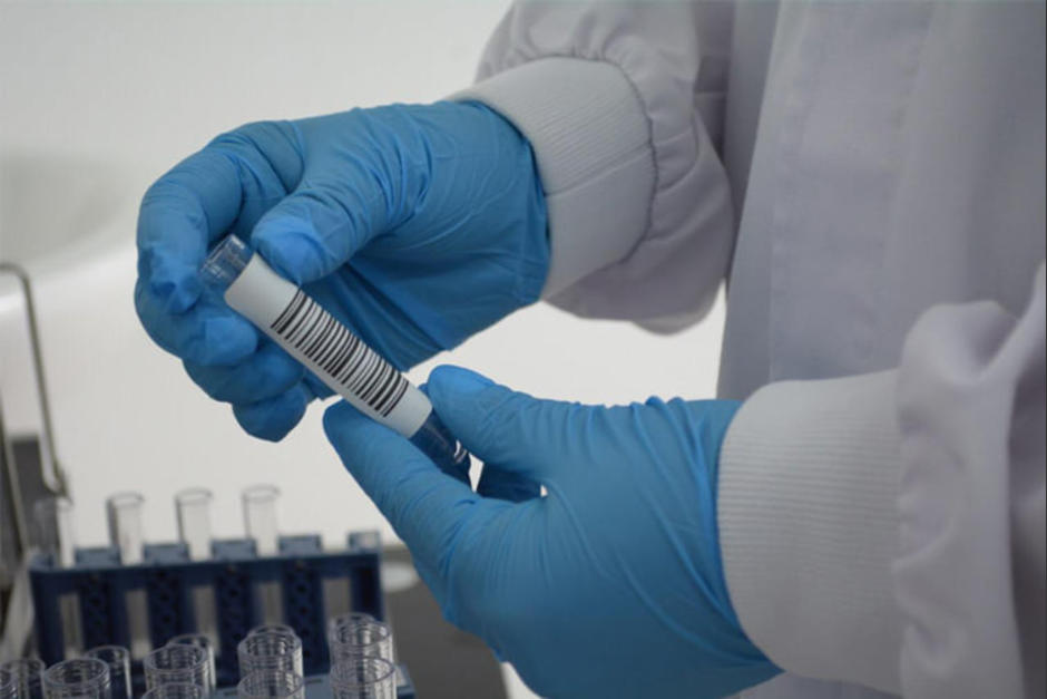 La nueva cepa del coronavirus ya afecta a varios pa&iacute;ses. (Foto: Ministerio de Salud)