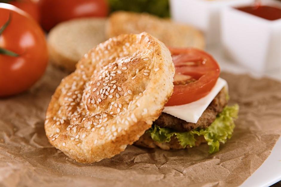 Estos restaurantes ofrecen opciones para los celiacos. (Foto: Nuss GT)&nbsp;