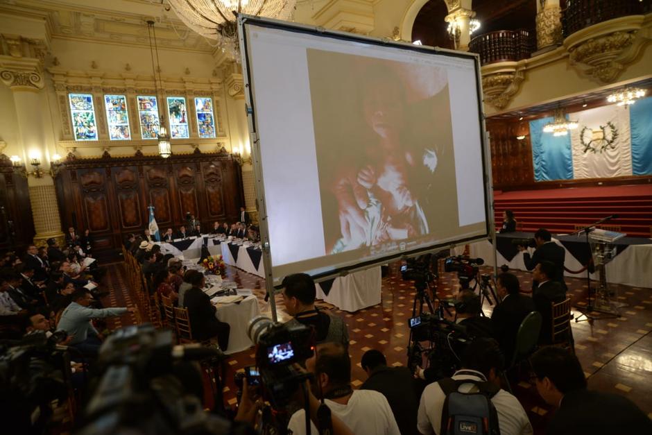 El presidente Alejandro Giammattei utiliz&oacute; la fotograf&iacute;a de un beb&eacute; con desnutrici&oacute;n para impulsar la lucha contra este flagelo. (Foto: Wilder L&oacute;pez/Soy502)