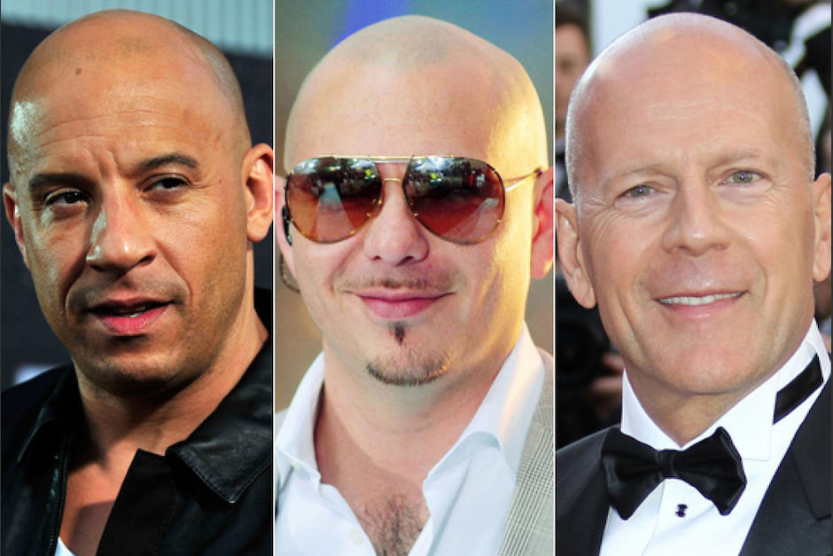 No Creer s C mo Luc an Estos Famosos Antes De Quedarse Calvos