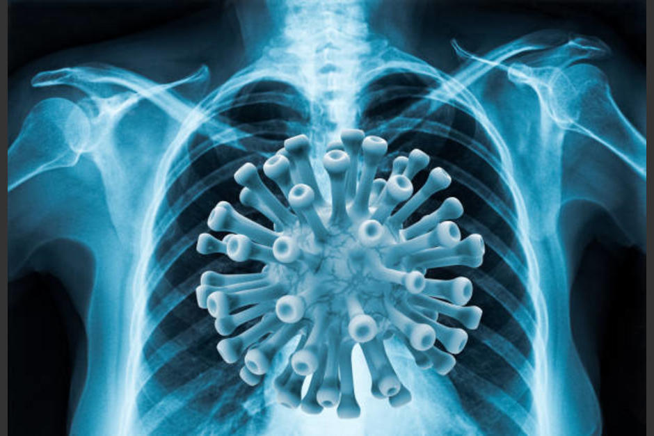 Los problemas que más persisten son la sensación de ahogo, la debilidad muscular y fatiga. (Foto: Vanidades)