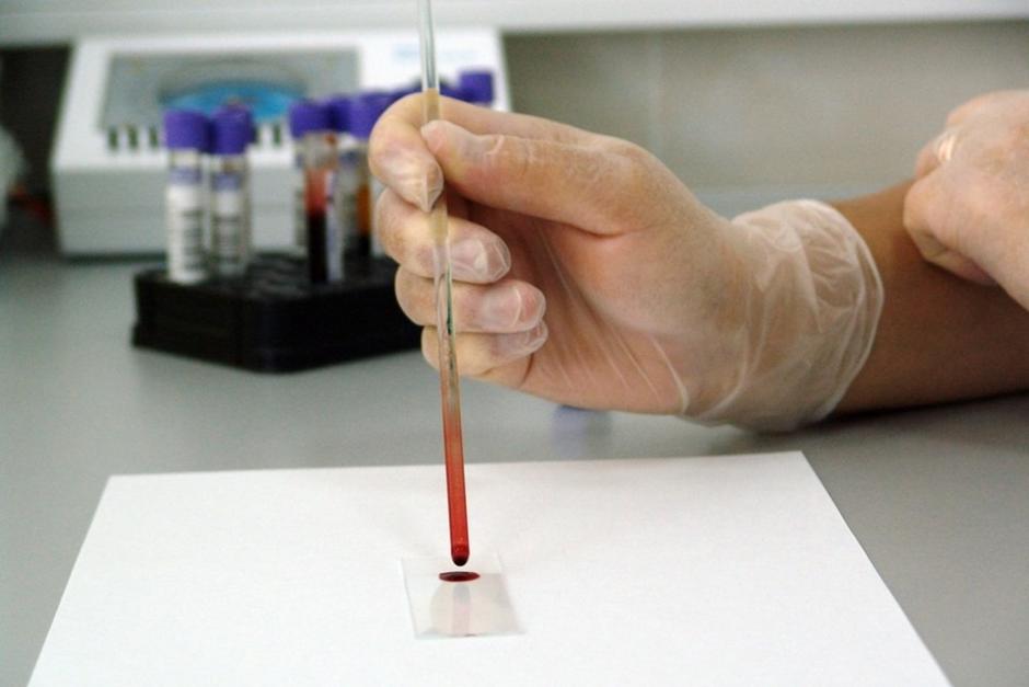 Dos nuevos estudios señalan que el tipo de sangre no es determinante. (Foto: PxHere)