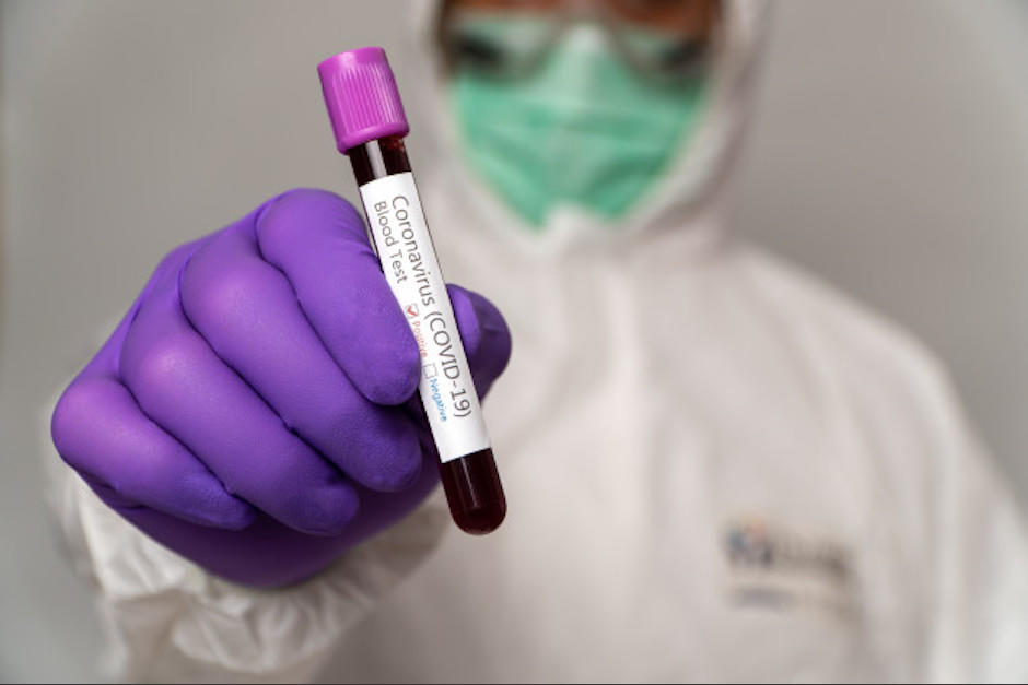 El Ministerio de Salud ha informado que se deben realizar 5 mil pruebas para identificar de manera correcta los casos de coronavirus en el paÃ­s. (Foto: Freepik)&nbsp;