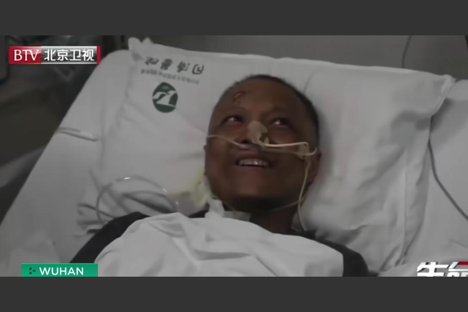 El médico pasó varios días inconsciente, tras adquirir la enfermedad y su hígado provocó cambio en la pigmentación de su piel. (Captura Video)