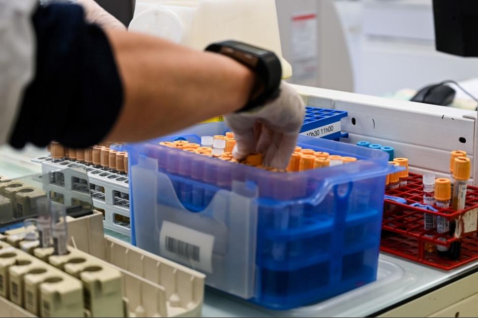 La farmac&eacute;utica acelera la producci&oacute;n de una mol&eacute;cula contra el coronavirus. (Foto: AFP)&nbsp;