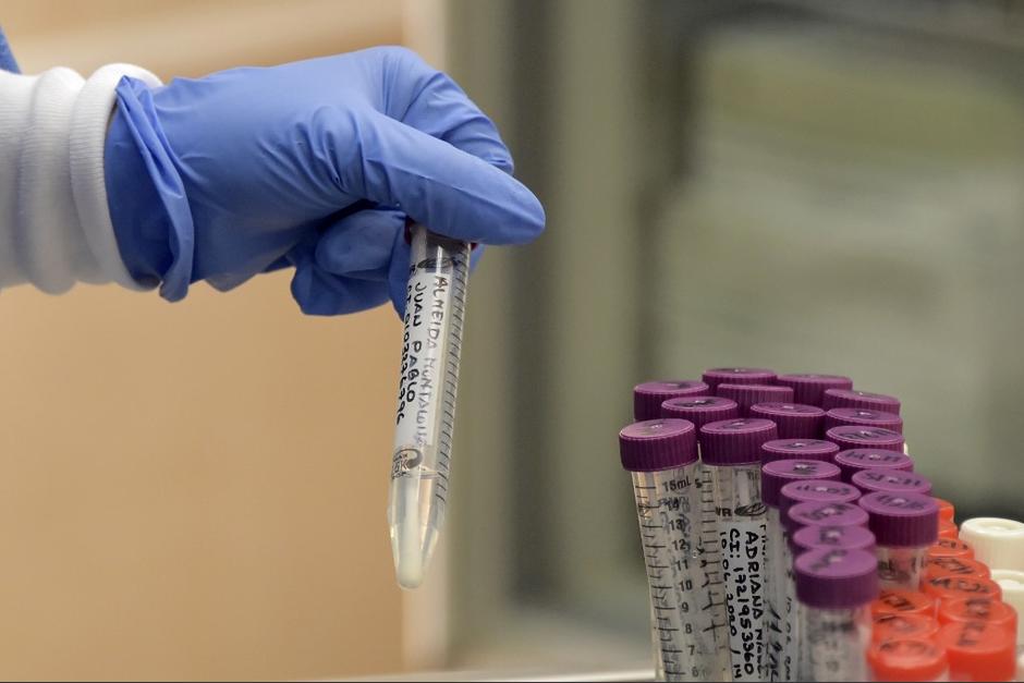 Según la diputada Lucrecia Hernández Mack, un informe del Ministerio de Salud revela que desde el 8 de junio pasado, el Laboratorio Nacional de Salud acumula casi 5 mil pruebas de Covid-19 sin procesar. (Foto: AFP)&nbsp;
