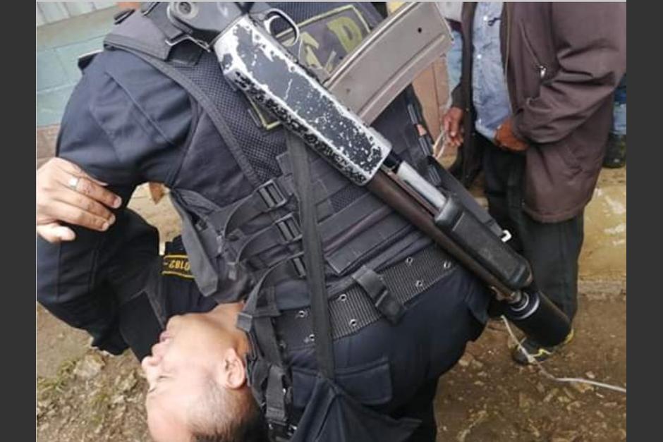 El agente de la PNC, Juan Calay Lux, fue herido por supuestos detractores de la hidroel&eacute;ctrica Ixquisis, ubicada en San Mateo Ixtat&aacute;n, Huehuetenango. (Foto: Twitter/@ActualidadHueh1)