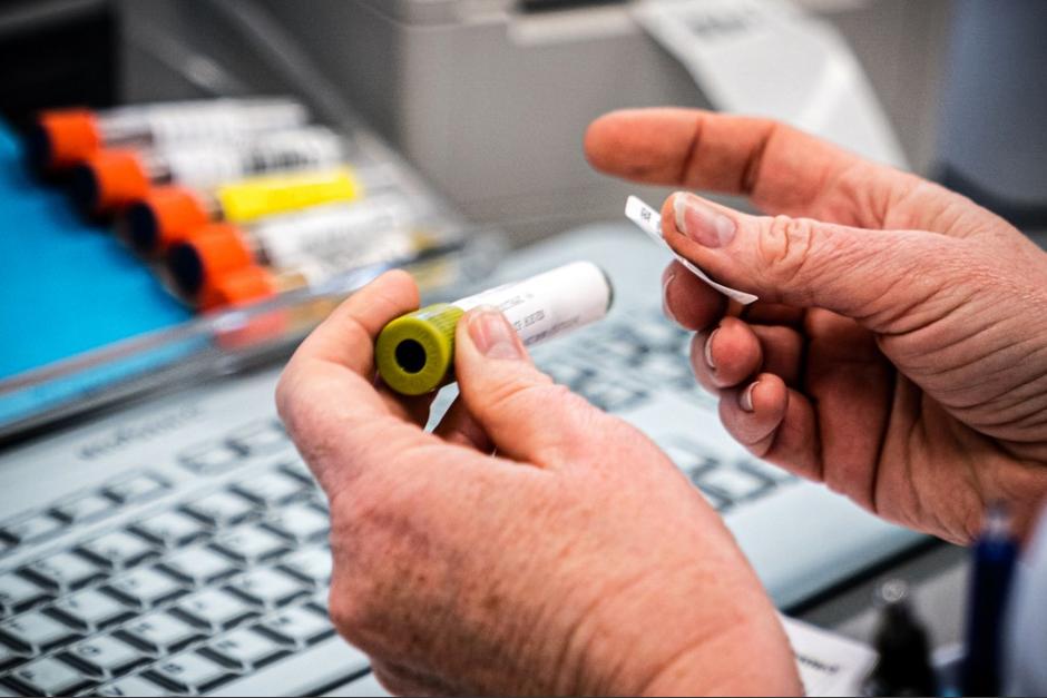 Un empleado de un laboratorio médico registra una muestra del nuevo coronavirus COVID-19 en Roosendaal, Países Bajos, el 4 de marzo de 2020. (Foto: AFP)