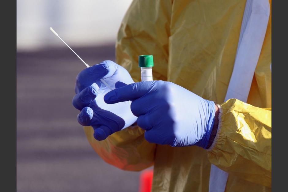 Los investigadores aceleran las pruebas para encontrar la cura contra el coronavirus. (Foto: AFP)